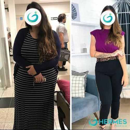 Before after photos of our patients 0